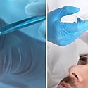 Exosome Hair Loss Therapy: Does It Work And Is It Safe?