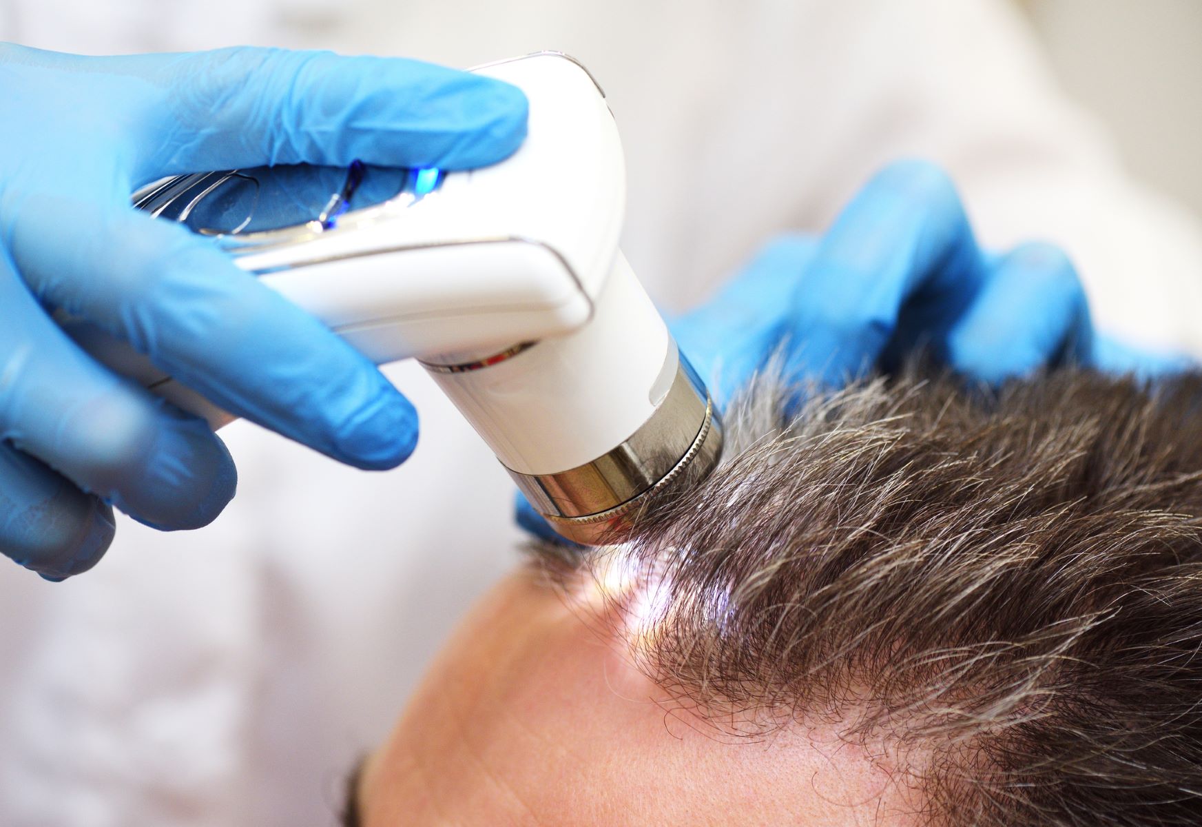 Man getting hair loss examination