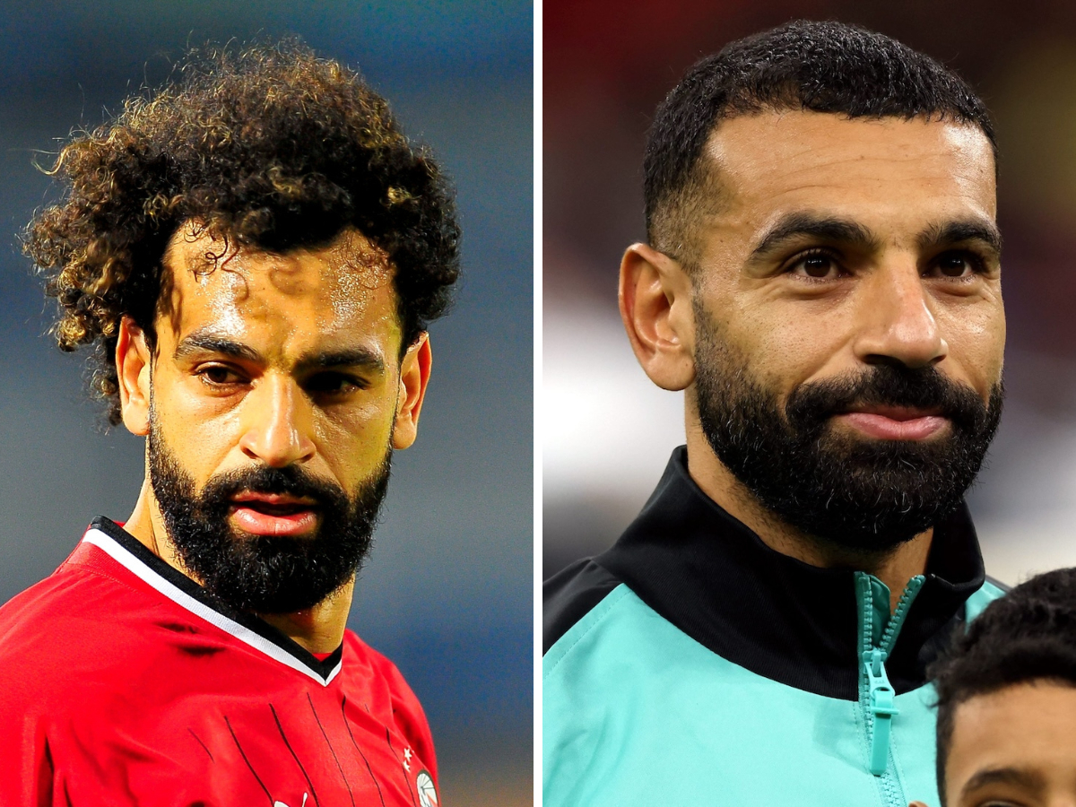 Mo Salah before and after hair transplant