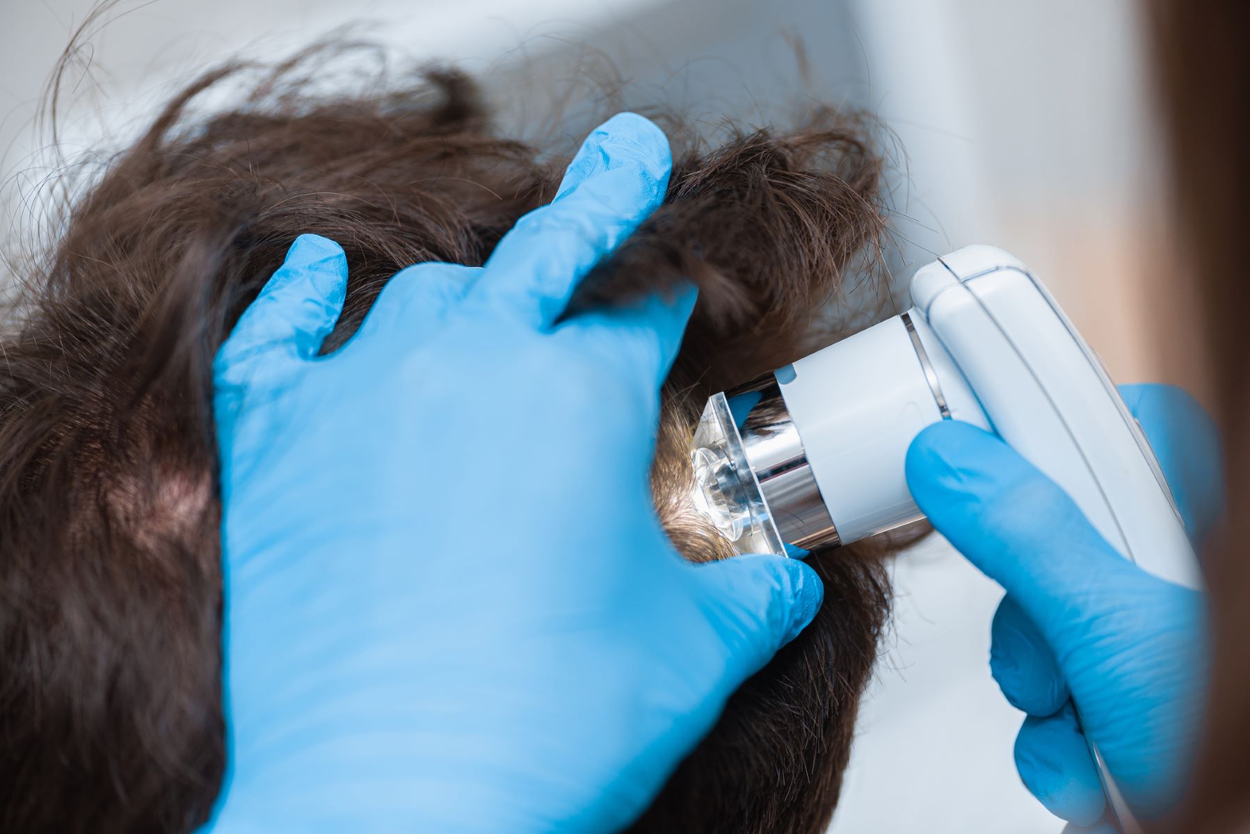 Trichologist examining patient with hair loss