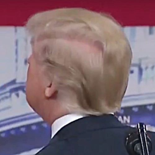 Trump’s bald spot