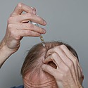 Does Minoxidil Expire? How Do You Know If It’s Gone Bad?
