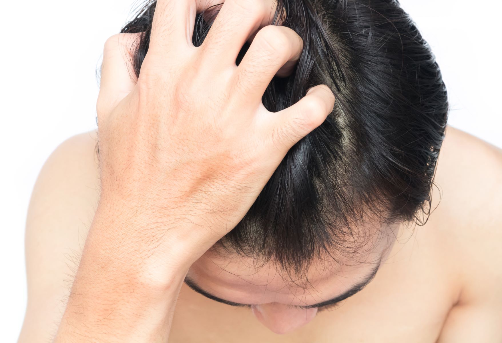 hair mesotherapy side effects