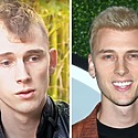 Machine Gun Kelly’s Hair Transplant: Did It Happen?
