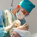 6000 Graft Hair Transplant: Coverage, Costs, Results