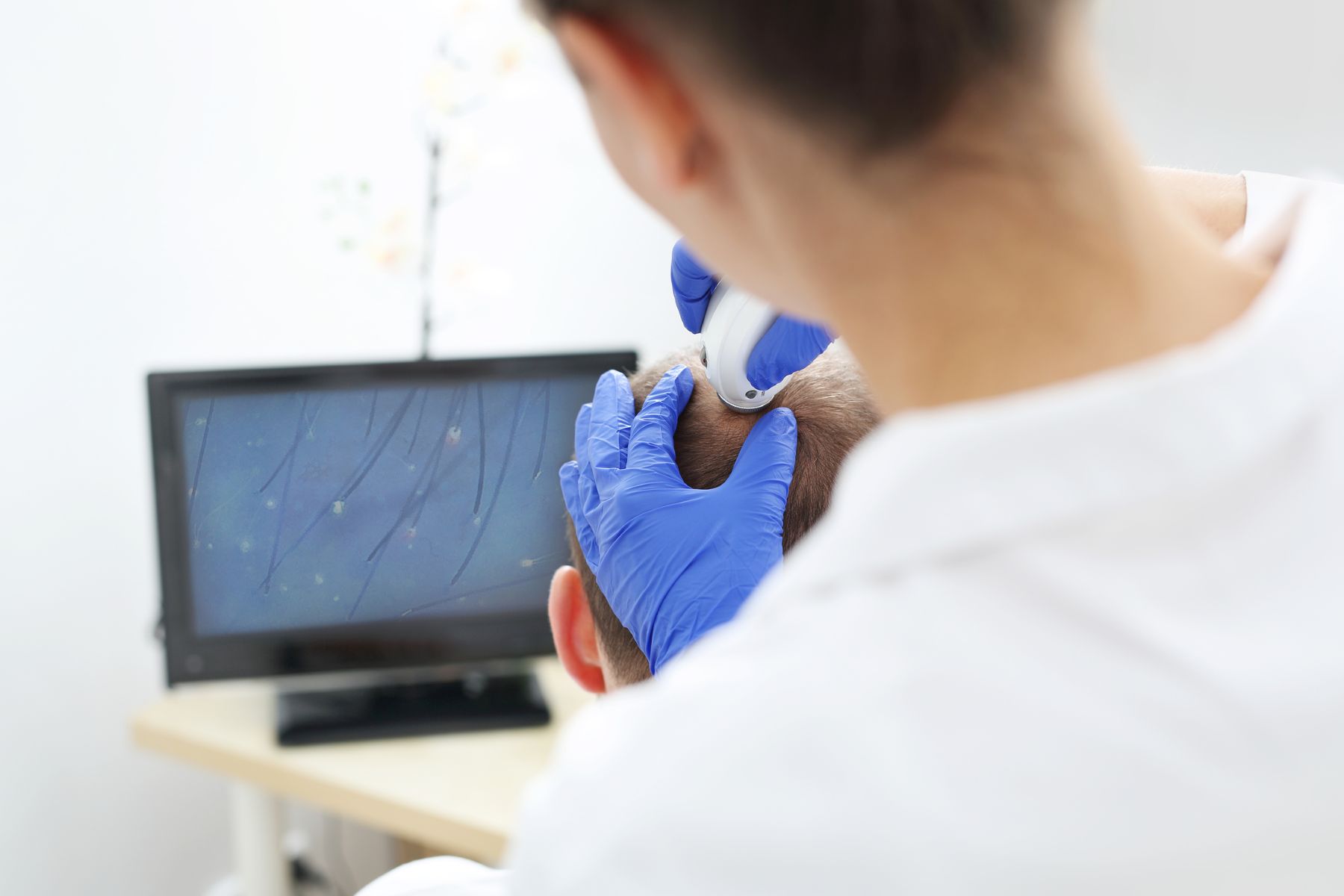 Doctor examining patient’s scalp