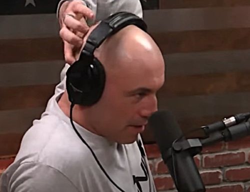 Joe Rogan discussing his hair transplant