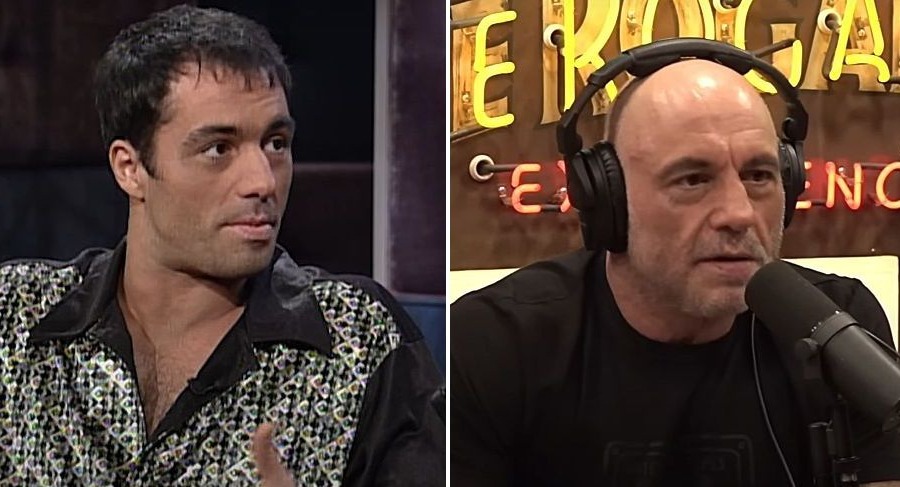 Joe Rogan’s Hair Transplant: Where Did Things Go Wrong?