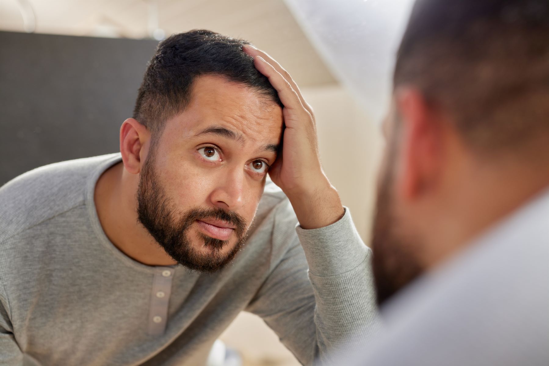 Man worried his transplanted hair is falling out