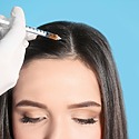 PRF For Hair Loss: Effectiveness, Costs, Side Effects