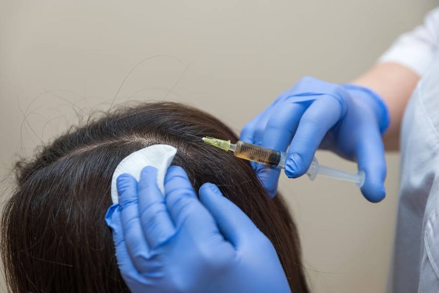 PRP Vs PRF For Hair Loss: Which Of These Options Works Best?