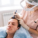 Hair Transplant Cost UK Vs Turkey: Prices, Results & Risks