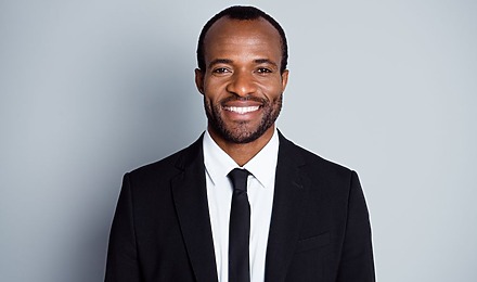 Receding Hairline Black Men
