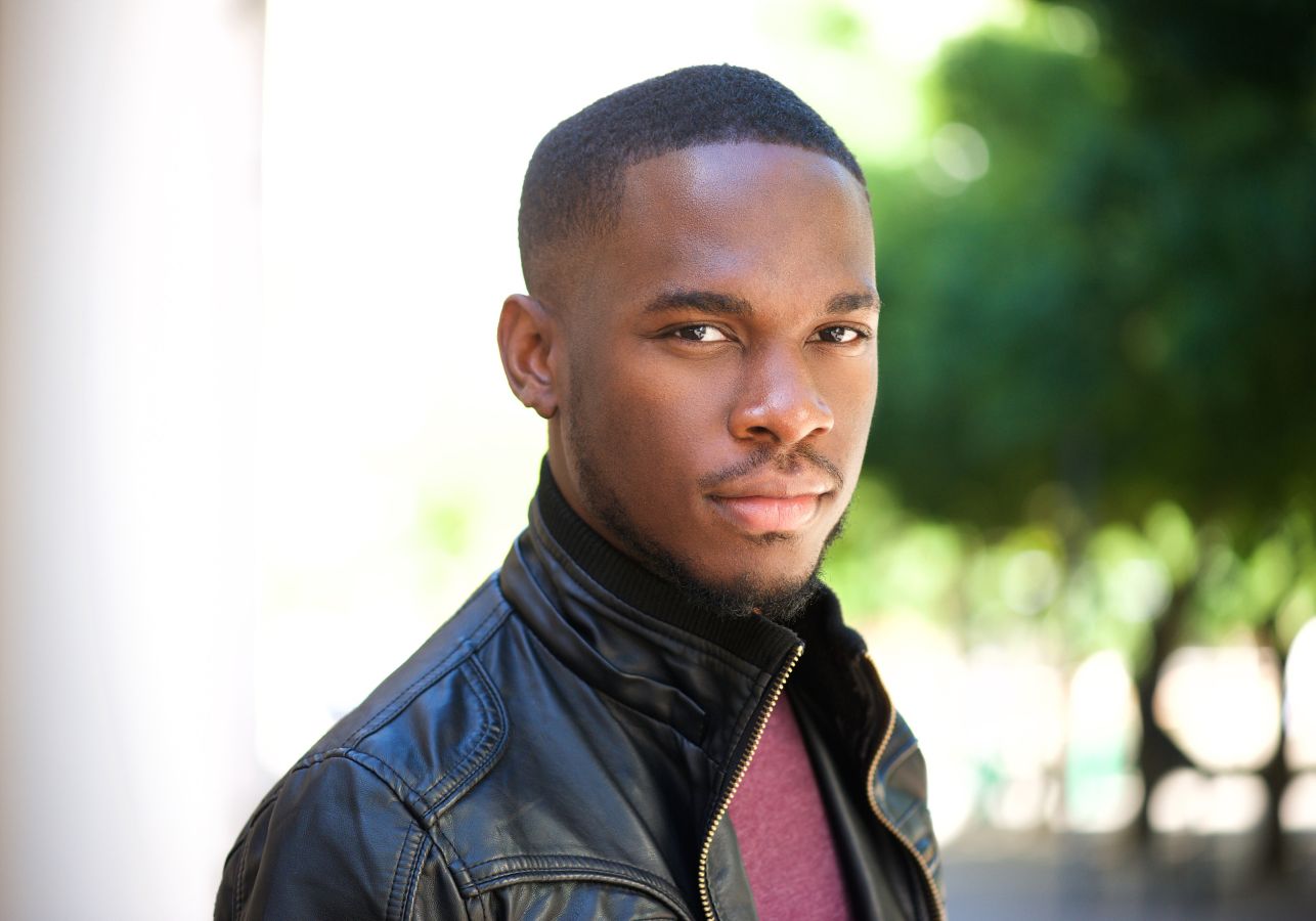 treating a receding hairline in Black men