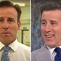 Anton Du Beke’s Hair Transplant: Details, Results, Costs