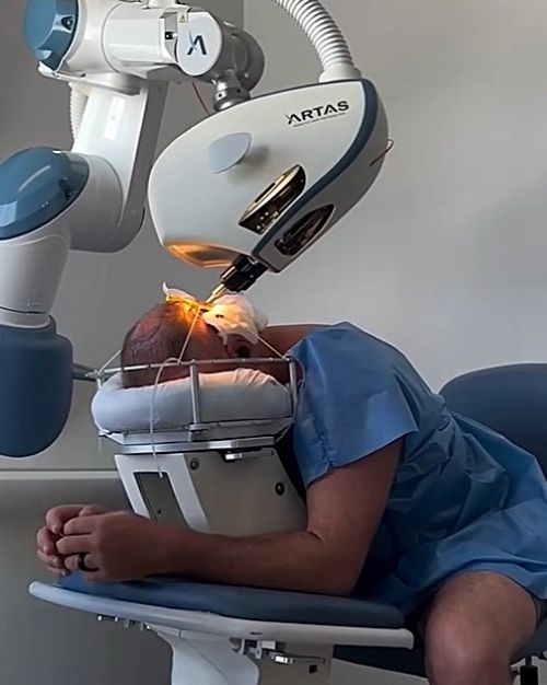 Man getting robotic hair transplant