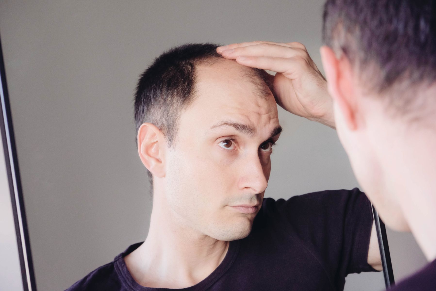 Man with androgenetic alopecia