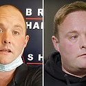 Peter Dale “Tubes” Hair Transplant – All You Need To Know