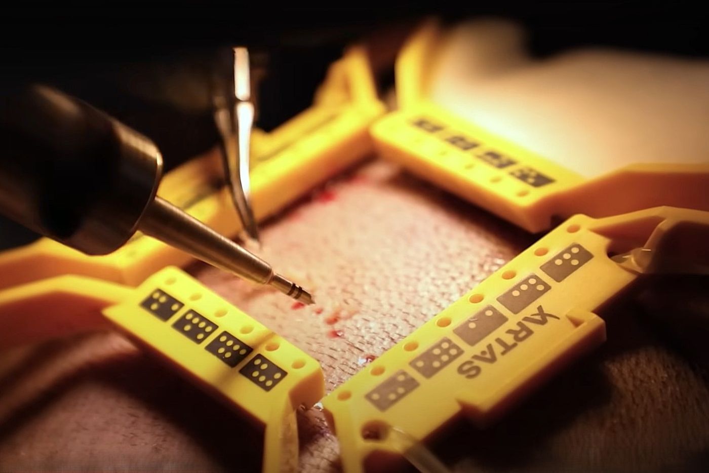 Robotic hair transplant graft harvesting