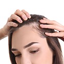Temporal Triangular Alopecia: Causes, Symptoms And Treatment