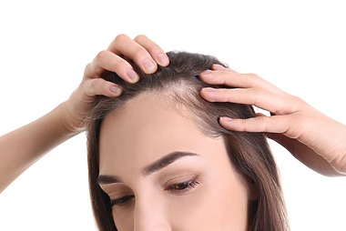 Temporal Triangular Alopecia: Causes, Symptoms And Treatment