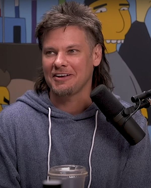 Theo Von after second hair transplant