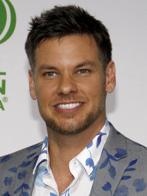 Theo Von before hair transplant