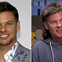 Theo Von’s Hair Transplants: Why Did He Have Them?