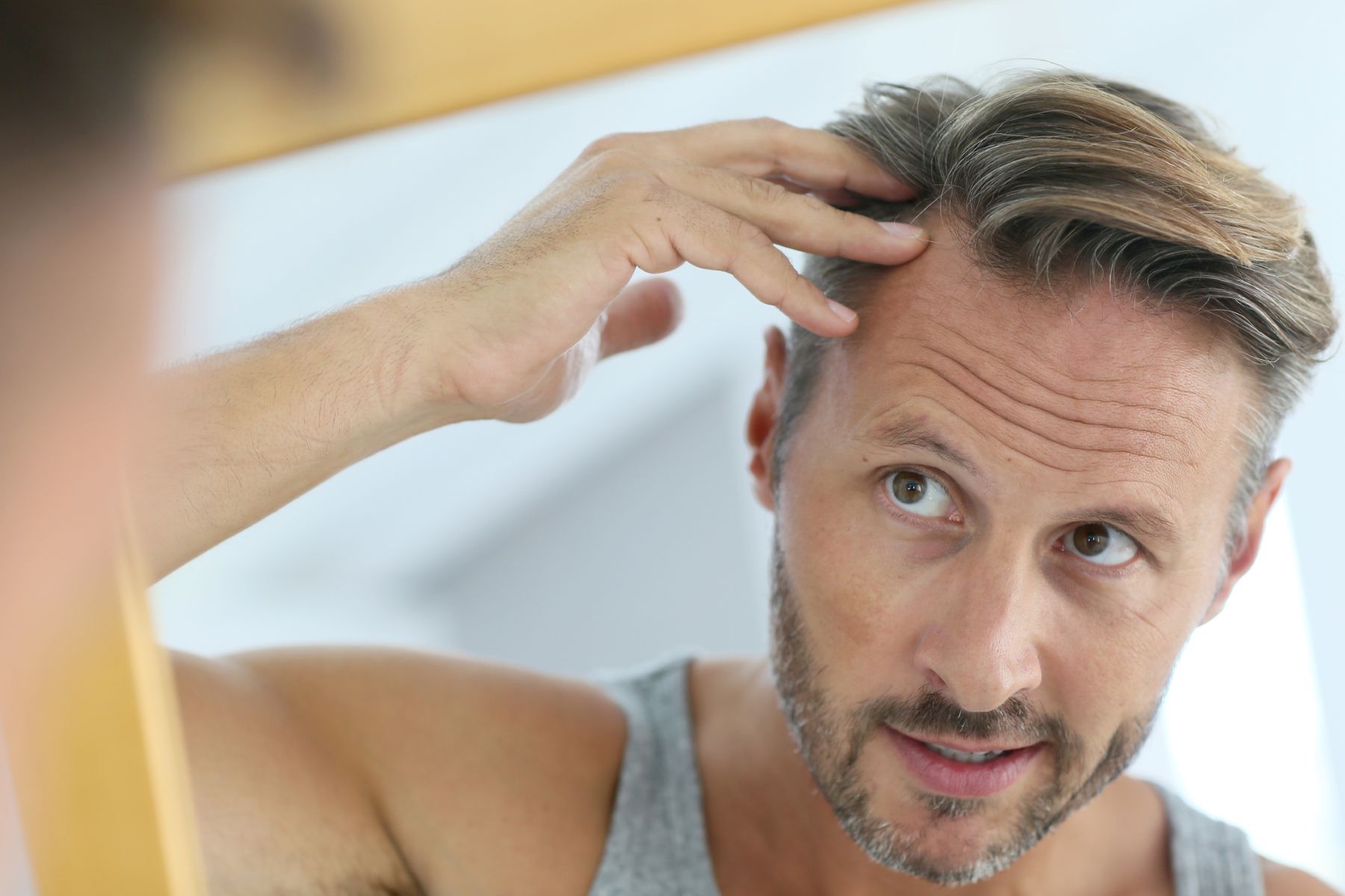 man wondering if he can have a robotic hair transplant