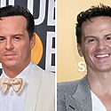 Andrew Scott’s Hair Transplant – Did It Really Happen?