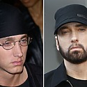 Eminem’s Beard Transplant: Did He Really Have One?