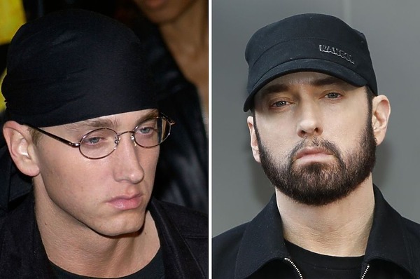 Eminem beard transplant