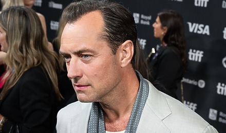 Jude Law Hair Transplant