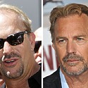 Kevin Costner’s Hair Transplant: Everything You Need To Know
