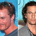 Matthew McConaughey’s Hair Transplant: Why The Rumour Started