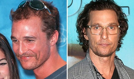 Matthew McConaughey’s Hair Transplant: Why The Rumour Started
