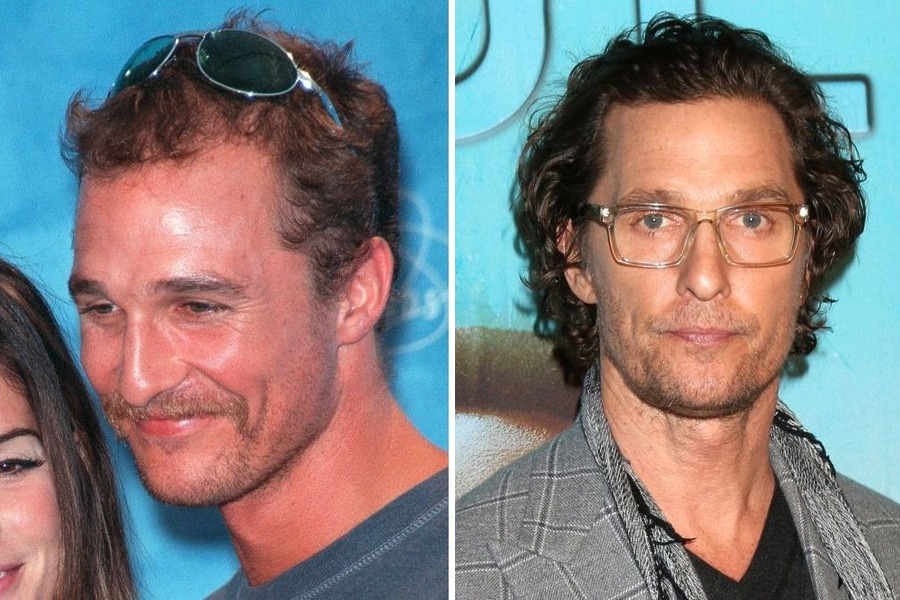 Matthew McConaughey’s Hair Transplant: Why The Rumour Started