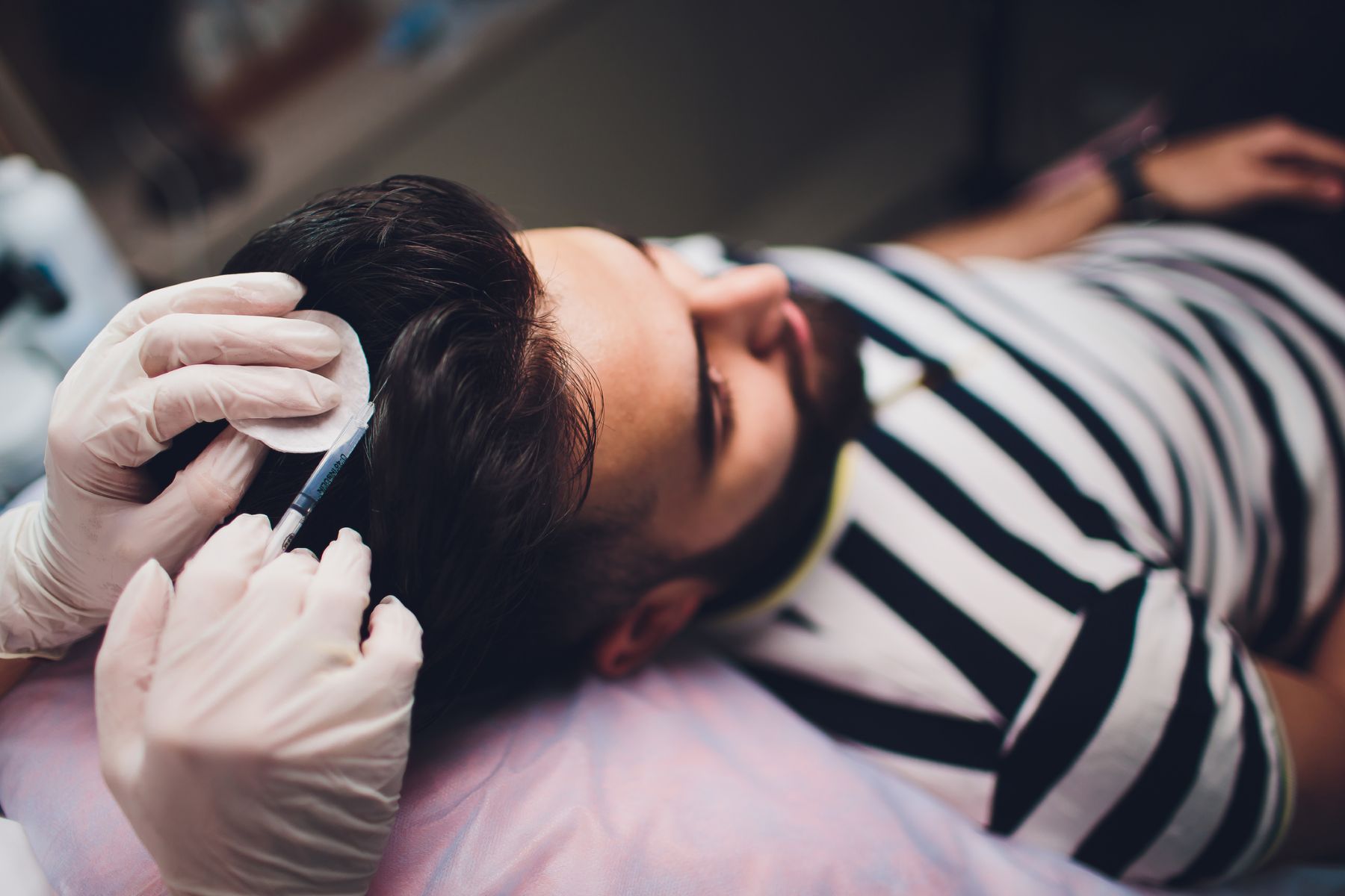 PRP hair treatment