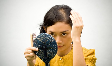 6 Common Types Of Hormonal Hair Loss: Symptoms & Treatments