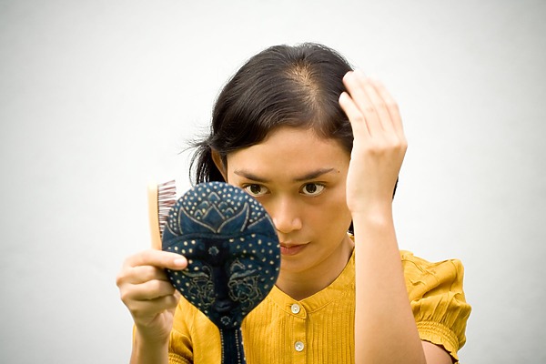 6 Common Types Of Hormonal Hair Loss: Symptoms & Treatments