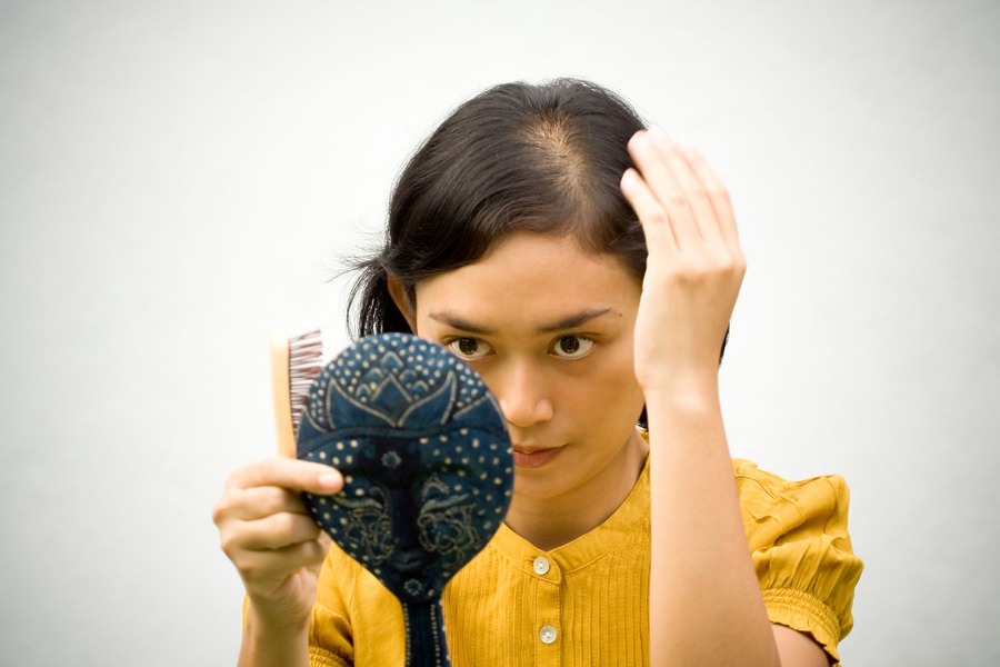 6 Common Types Of Hormonal Hair Loss: Symptoms & Treatments