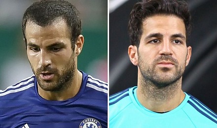 Cesc Fàbregas Hair Transplant