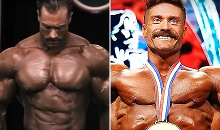 Chris Bumstead’s Hair Transplant - The Full Scoop