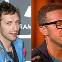 Chris Martin’s Hair Transplant: Are The Rumours True?