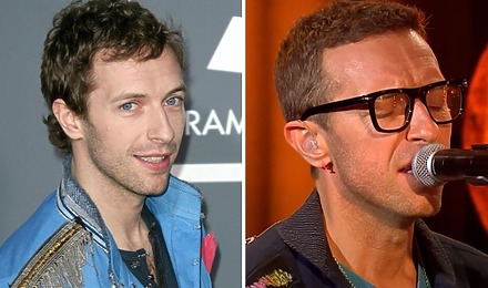 Chris Martin’s Hair Transplant: Are The Rumours True?