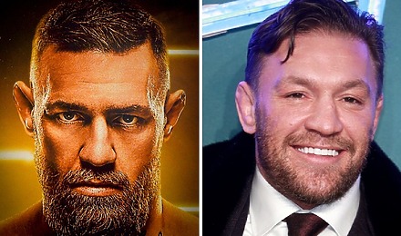 Did Conor McGregor’s Hair Transplant Happen (And Fail)