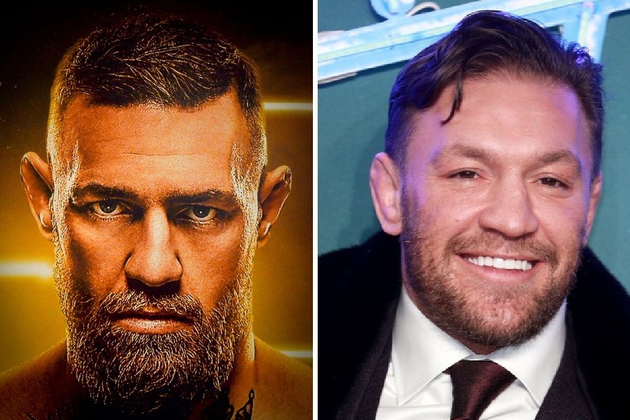 Did Conor McGregor’s Hair Transplant Happen (And Fail)