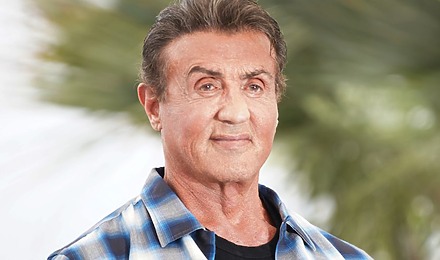 Sylvester Stallone Hair Transplant