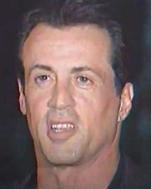 Sylvester Stallone’s hair in 1995