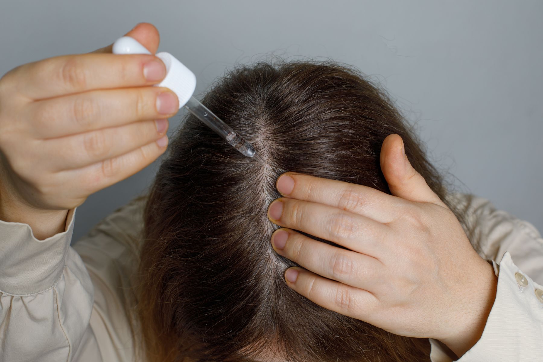 Woman treating medication-induced hair loss